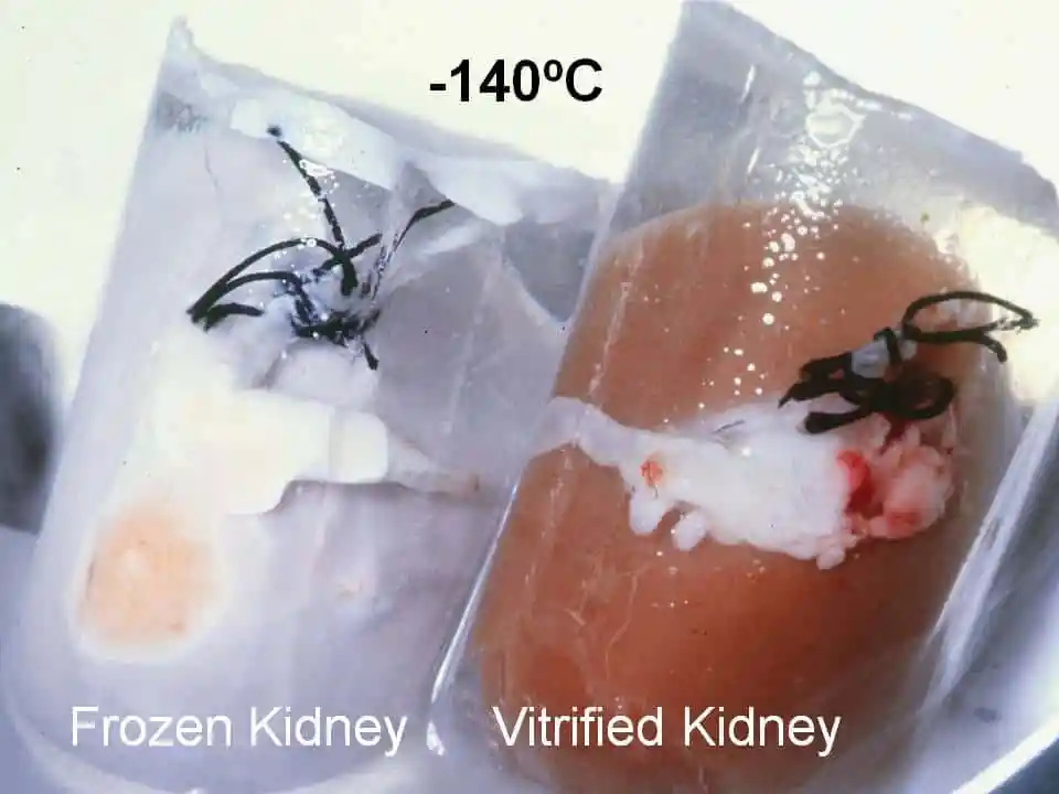 vitrification