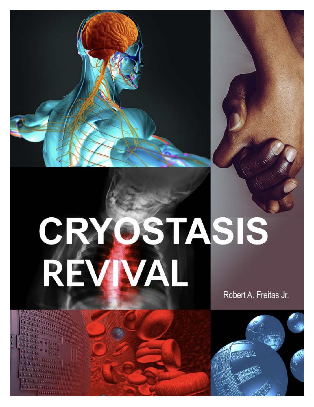 cryostasis-revival - Alcor Cryostasis Revival